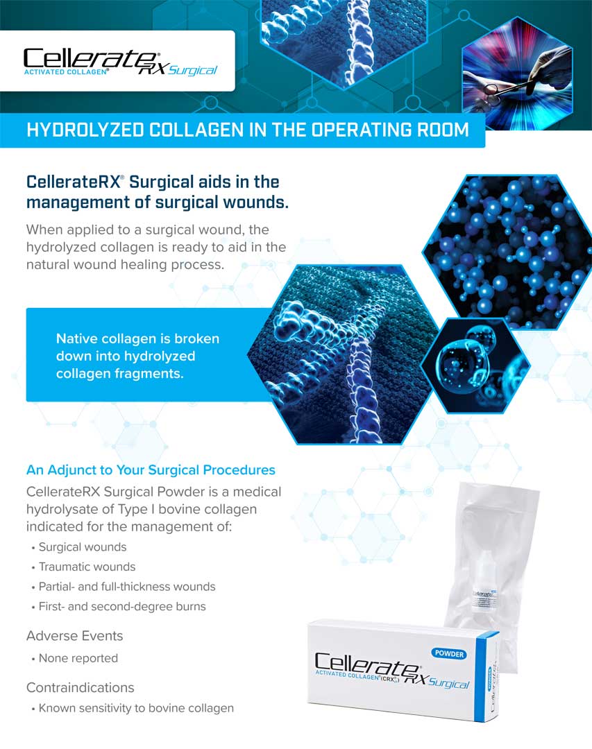CellerateRX Surgical Brochure 1